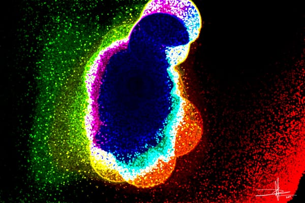 Mitosis 5